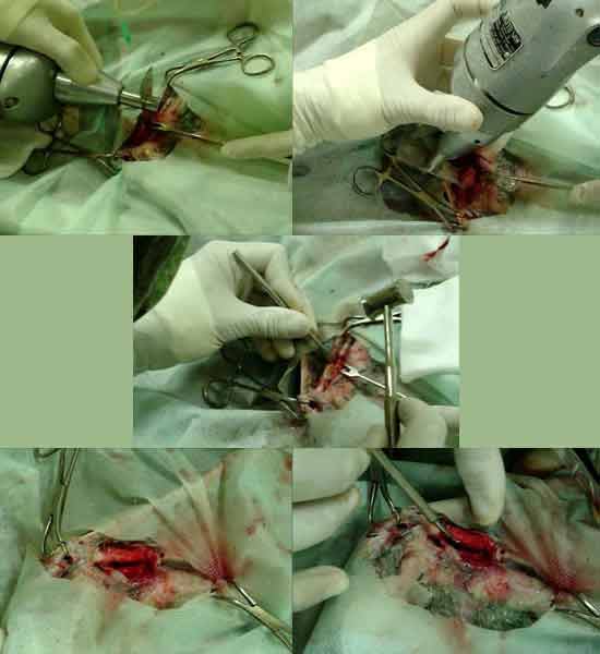 operando1